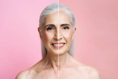 Full Facelift Surgery in Turkey