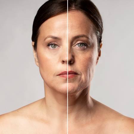 Lifting facial profundo en Turquía